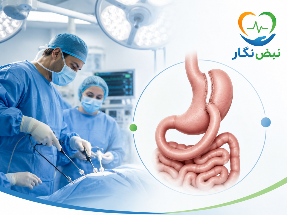 مینی بای پس معده چیست؟ | مزایا، معایب، عوارض، هزینه و تفاوت با اسلیو معده